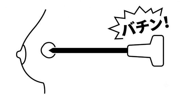 針生検